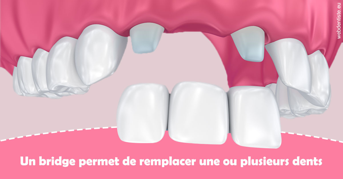 https://dr-dada-karim.chirurgiens-dentistes.fr/Bridge remplacer dents 2