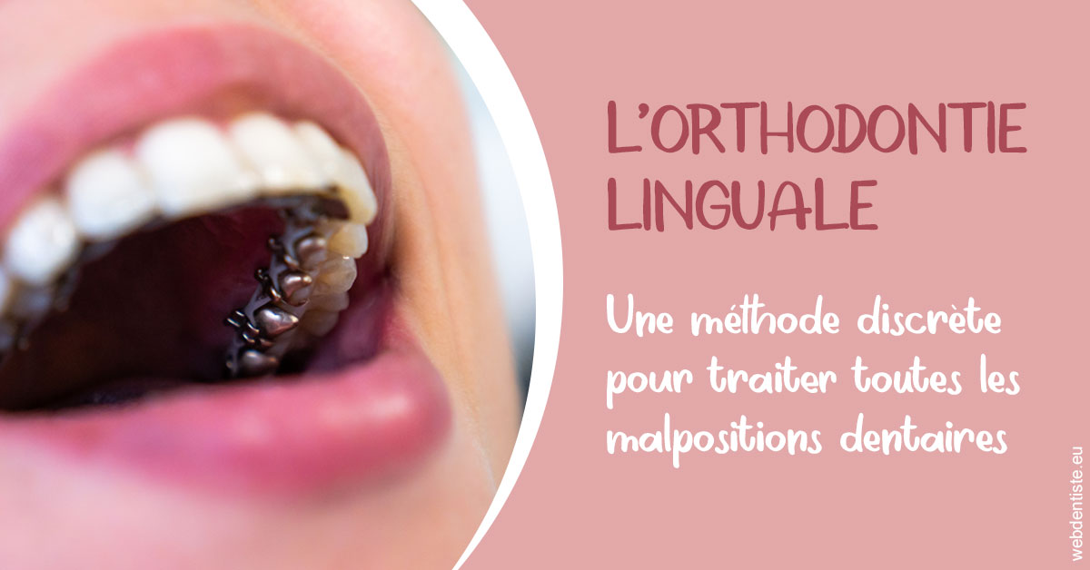 https://dr-dada-karim.chirurgiens-dentistes.fr/L'orthodontie linguale 2