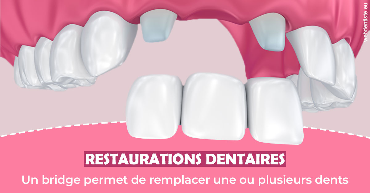 https://dr-dada-karim.chirurgiens-dentistes.fr/Bridge remplacer dents 2