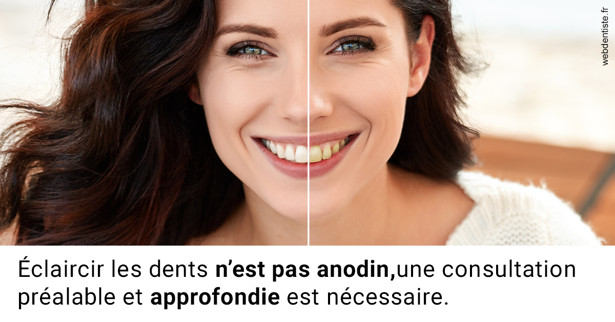 https://dr-dada-karim.chirurgiens-dentistes.fr/Le blanchiment 2