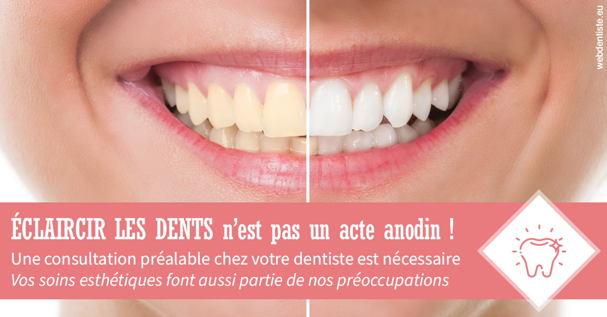 https://dr-dada-karim.chirurgiens-dentistes.fr/Eclaircir les dents 1