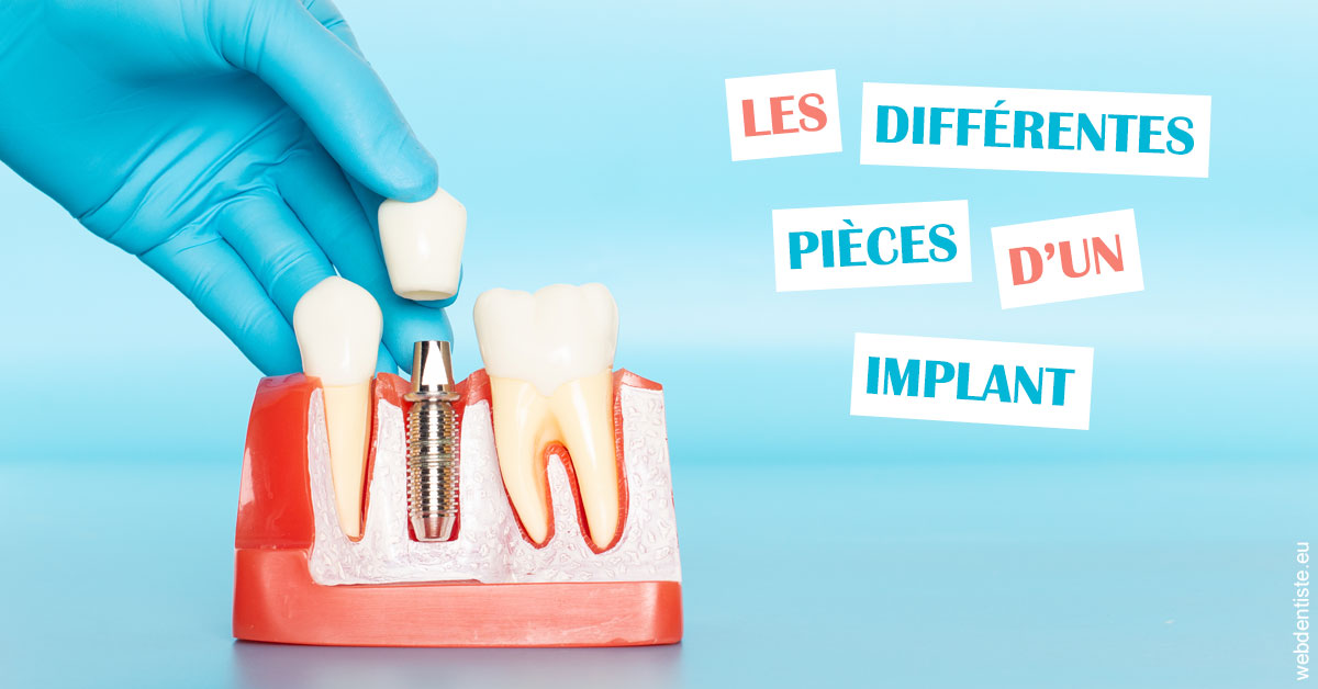 https://dr-dada-karim.chirurgiens-dentistes.fr/Les différentes pièces d’un implant 2