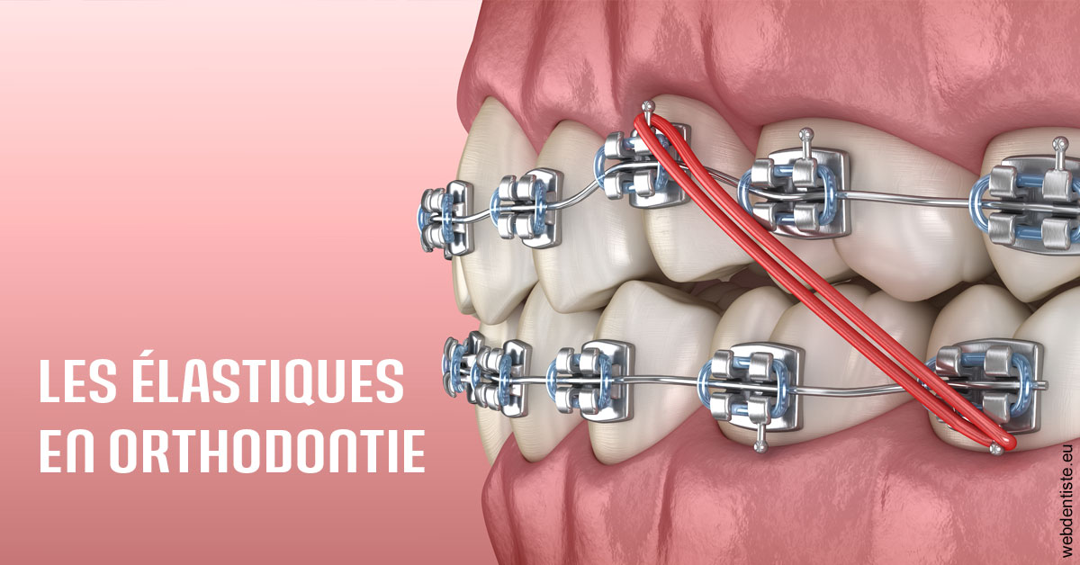 https://dr-dada-karim.chirurgiens-dentistes.fr/Elastiques orthodontie 2